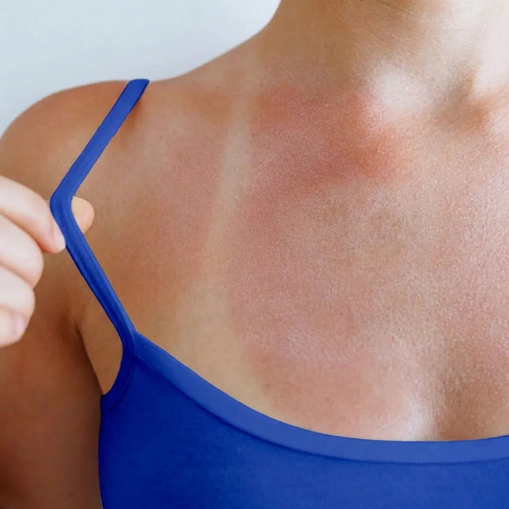 Miss a spot — sunscreen falls short